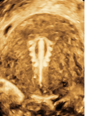 3D-4D OBGY Ultrasound