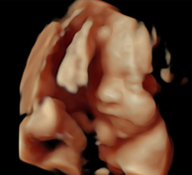 Advanced OBGY Ultrasound 1 week to 4 months