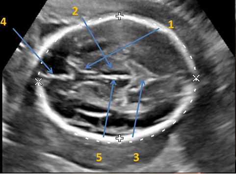 Basic OBGY Ultrasound
