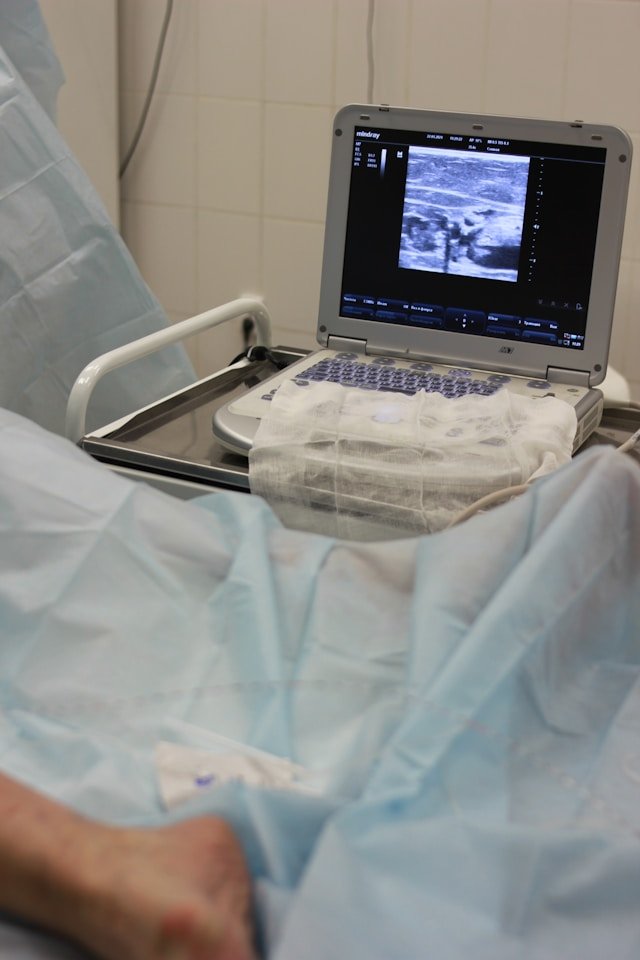 Musculoskeletal Sonography