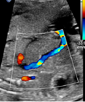 Obstetric Doppler Program