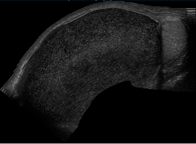 Small Parts Ultrasound